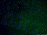 TREM2 Antibody in Immunohistochemistry (PFA fixed) (IHC (PFA))