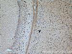 TREM2 Antibody in Immunohistochemistry (Paraffin) (IHC (P))