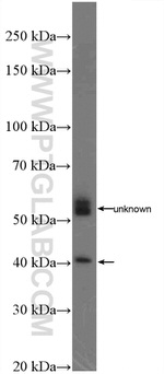 TREM2 Antibody in Western Blot (WB)