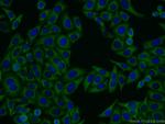MTMR4 Antibody in Immunocytochemistry (ICC/IF)