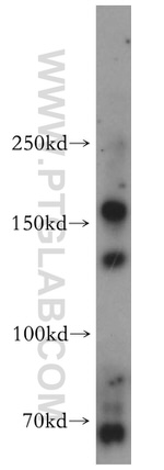 MTMR4 Antibody in Western Blot (WB)