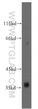 USP46 Antibody in Western Blot (WB)