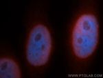 SNRPB2 Antibody in Immunocytochemistry (ICC/IF)