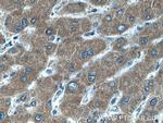 Choline kinase alpha Antibody in Immunohistochemistry (Paraffin) (IHC (P))