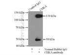 Choline kinase alpha Antibody in Immunoprecipitation (IP)