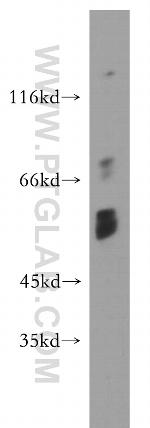 Choline kinase alpha Antibody in Western Blot (WB)