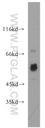 Choline kinase alpha Antibody in Western Blot (WB)