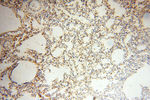 P2RX4 Antibody in Immunohistochemistry (Paraffin) (IHC (P))