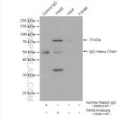 PAK6 Antibody in Immunoprecipitation (IP)