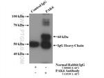 PAK6 Antibody in Immunoprecipitation (IP)