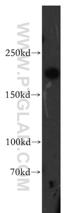 Alpha-2-macroglobulin Antibody in Western Blot (WB)