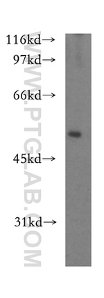 ST3GAL4 Antibody in Western Blot (WB)