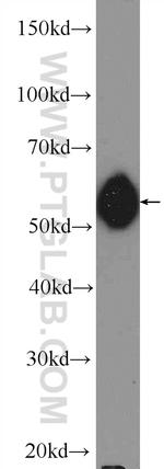 PNKP Antibody in Western Blot (WB)