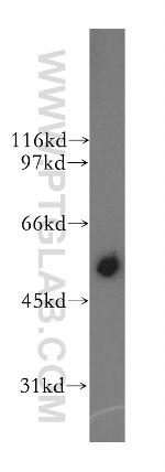 CYP2J2 Antibody in Western Blot (WB)