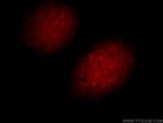 UIMC1 Antibody in Immunocytochemistry (ICC/IF)