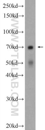 ENTPD2 Antibody in Western Blot (WB)