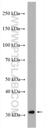 SLC35A2 Antibody in Western Blot (WB)