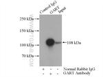 GART Antibody in Immunoprecipitation (IP)