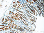 CA7 Antibody in Immunohistochemistry (Paraffin) (IHC (P))