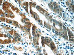 CA7 Antibody in Immunohistochemistry (Paraffin) (IHC (P))