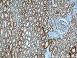 CA7 Antibody in Immunohistochemistry (Paraffin) (IHC (P))