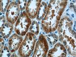 CA7 Antibody in Immunohistochemistry (Paraffin) (IHC (P))