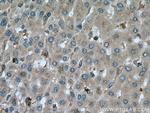 CA7 Antibody in Immunohistochemistry (Paraffin) (IHC (P))