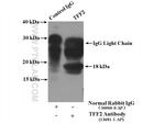 TFF2 Antibody in Immunoprecipitation (IP)