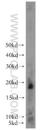 TFF2 Antibody in Western Blot (WB)