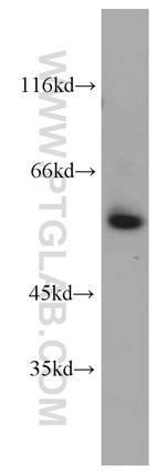 VEGFR-1/FLT-1 Antibody in Western Blot (WB)