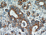 NEDD4L Antibody in Immunohistochemistry (Paraffin) (IHC (P))