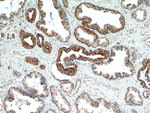 NEDD4L Antibody in Immunohistochemistry (Paraffin) (IHC (P))