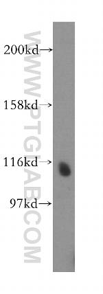 NEDD4L Antibody in Western Blot (WB)