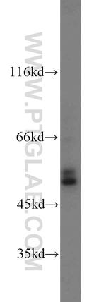 Carboxypeptidase E Antibody in Western Blot (WB)