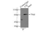 LSS Antibody in Immunoprecipitation (IP)