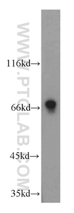 LSS Antibody in Western Blot (WB)