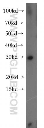 CBR4 Antibody in Western Blot (WB)