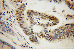 RNMT Antibody in Immunohistochemistry (Paraffin) (IHC (P))