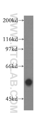 RNMT Antibody in Western Blot (WB)