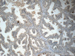 P4HA2 Antibody in Immunohistochemistry (Paraffin) (IHC (P))