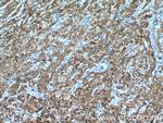 P4HA2 Antibody in Immunohistochemistry (Paraffin) (IHC (P))