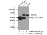 P4HA2 Antibody in Immunoprecipitation (IP)