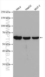 P4HA2 Antibody in Western Blot (WB)