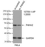 P4HA2 Antibody in Western Blot (WB)