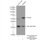 PFKFB3 Antibody in Immunoprecipitation (IP)