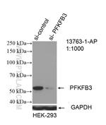 PFKFB3 Antibody in Western Blot (WB)