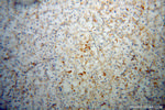 TRAK2 Antibody in Immunohistochemistry (Paraffin) (IHC (P))