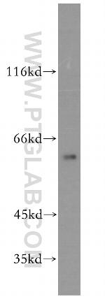 CPNE6 Antibody in Western Blot (WB)