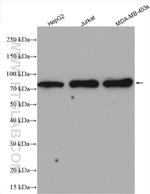 PARN Antibody in Western Blot (WB)