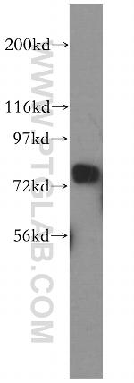 PARN Antibody in Western Blot (WB)